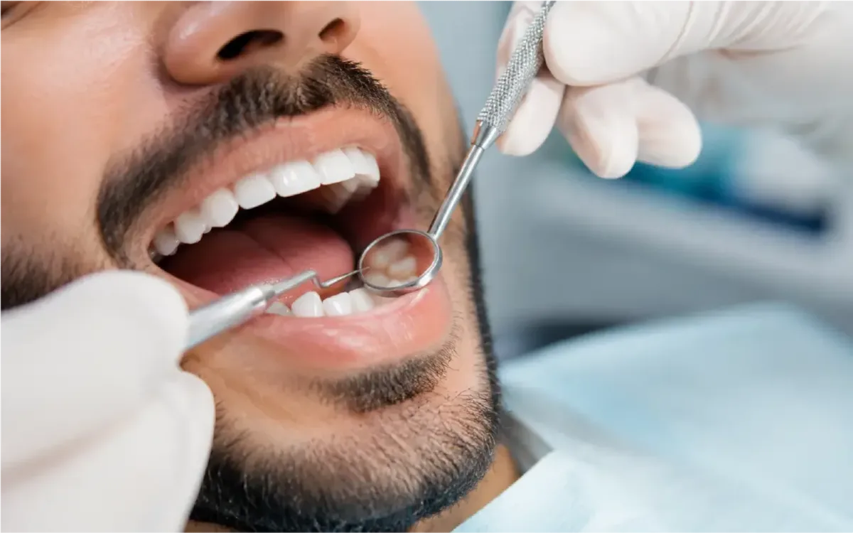 Professional Scaling & Polishing in Karachi
