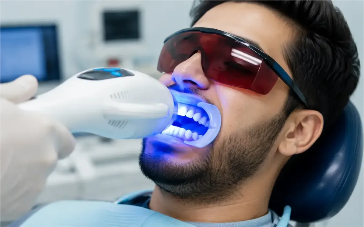 Teeth Whitening
