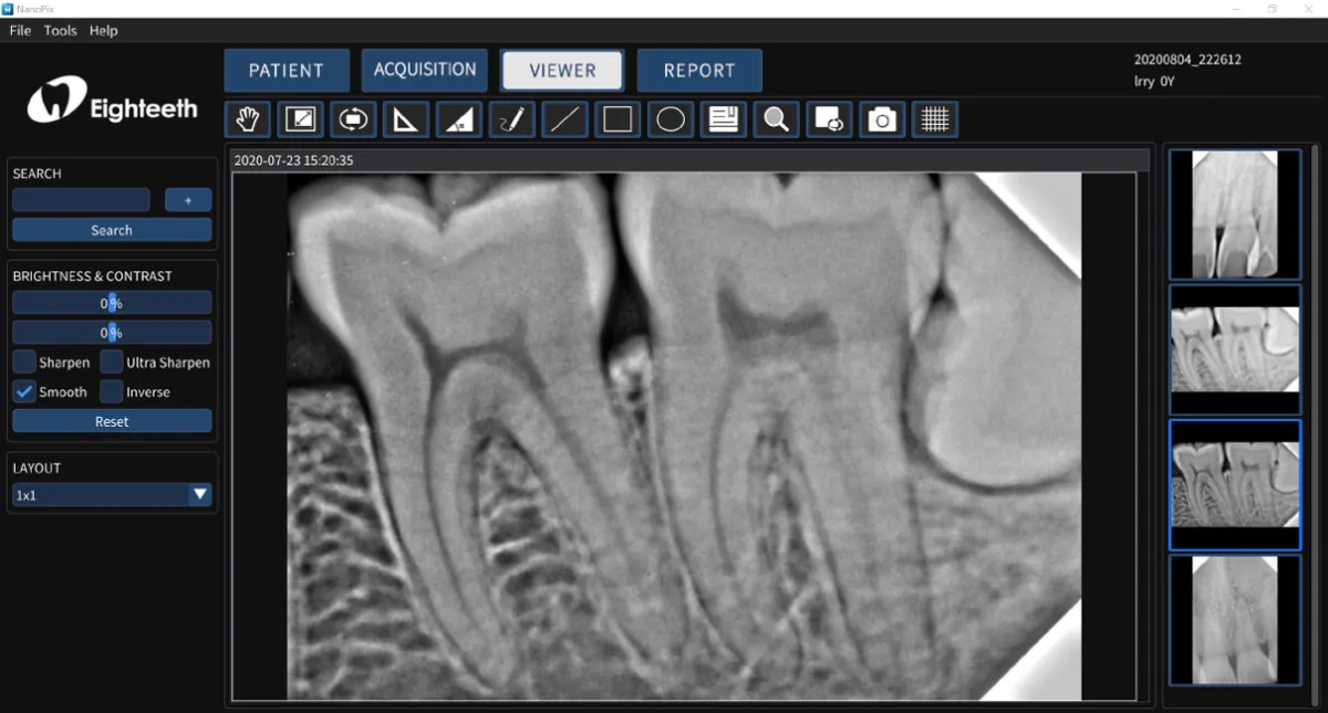 Digital Dental X-Rays in Karachi | NanoPix AI Imaging