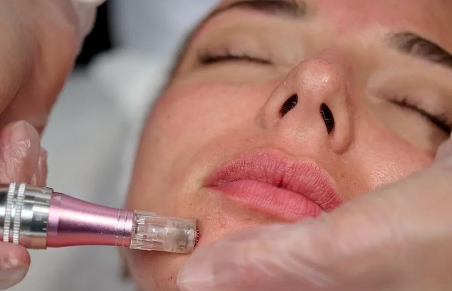 Mesotherapy
